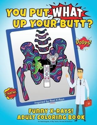 You Put What Up Your Butt? Funny Adult Coloring Book for Radiologists, X-Ray Techs, Nurses & Doctors by Unicorn, Bad Perm