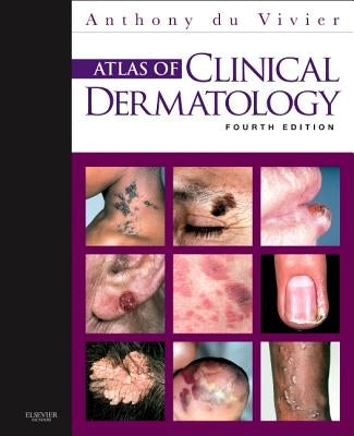 Atlas of Clinical Dermatology by Du Vivier, Anthony
