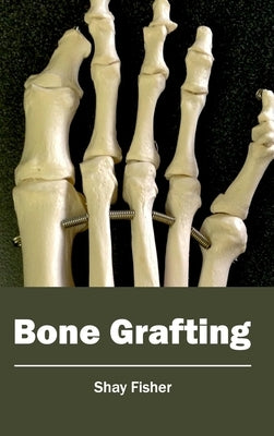 Bone Grafting by Fisher, Shay