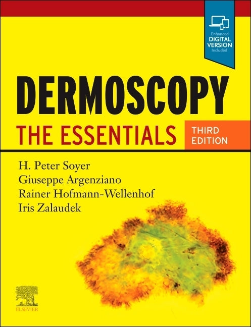 Dermoscopy: The Essentials by Soyer, H. Peter
