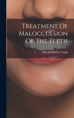 Treatment Of Malocculsion Of The Teeth by Angle, Edward Hartley