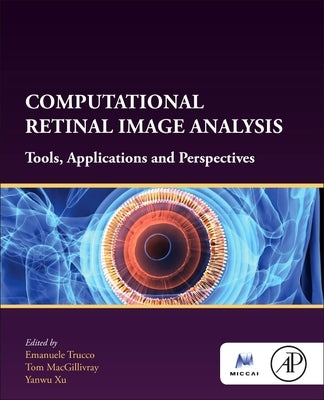 Computational Retinal Image Analysis: Tools, Applications and Perspectives by Trucco, Emanuele