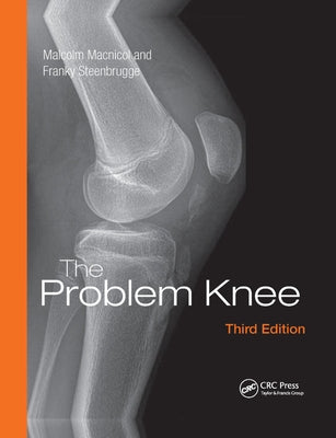 The Problem Knee by MacNicol, Malcolm