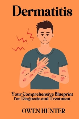 Dermatitis: Your Comprehensive Blueprint for Diagnosis and Treatment by Hunter, Owen