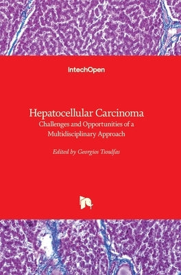 Hepatocellular Carcinoma: Challenges and Opportunities of a Multidisciplinary Approach by Tsoulfas, Georgios