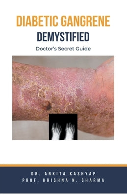 Diabetic Gangrene Demystified: Doctor's Secret Guide by Kashyap, Ankita