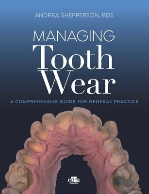 Managing Tooth Wear (C) / Shepperson by Shepperson, Andrea