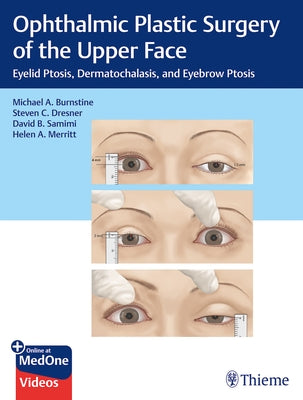 Ophthalmic Plastic Surgery of the Upper Face: Eyelid Ptosis, Dermatochalasis, and Eyebrow Ptosis by Burnstine, Michael A.