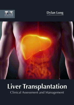 Liver Transplantation: Clinical Assessment and Management by Long, Dylan