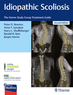 Idiopathic Scoliosis: The Harms Study Group Treatment Guide by Newton, Peter