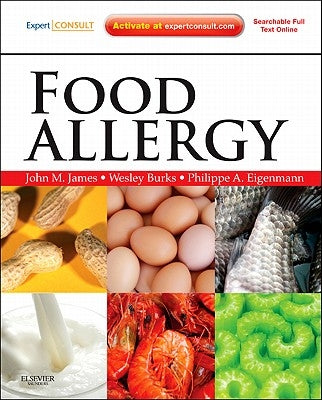 Food Allergy by James, John M.