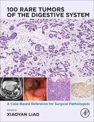 100 Rare Tumors of the Digestive System: A Case-Based Reference for Surgical Pathologists by Liao, Xiaoyan