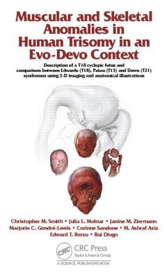 Muscular and Skeletal Anomalies in Human Trisomy in an Evo-Devo Context: Description of a T18 Cyclopic Fetus and Comparison Between Edwards (T18), Pat by Diogo, Rui