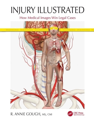 Injury Illustrated: How Medical Images Win Legal Cases by Gough, R.