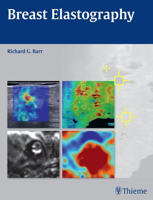 Breast Elastography by Barr, Richard G.