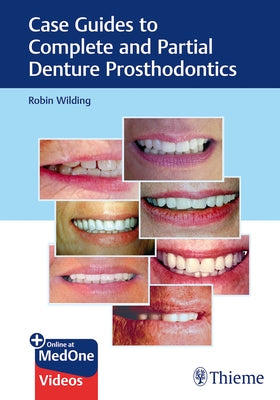 Case Guides to Complete and Partial Denture Prosthodontics by Wilding, Robin
