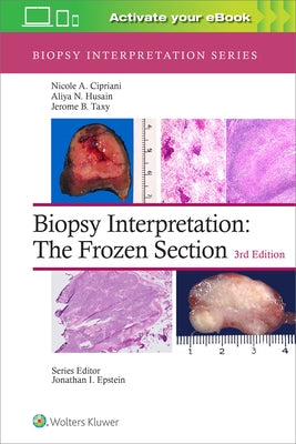 Biopsy Interpretation: The Frozen Section by Cipriani, Nicole A.