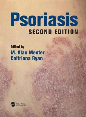 Psoriasis by Menter, M. Alan