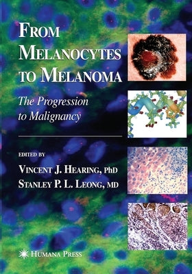 From Melanocytes to Melanoma: The Progression to Malignancy by Hearing, Vincent J.