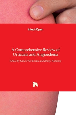 Urticaria and Angioedema: A Comprehensive Review of by Kartal, Selda Pelin