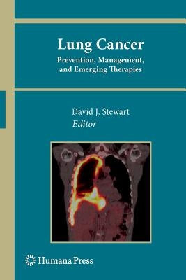 Lung Cancer:: Prevention, Management, and Emerging Therapies by Stewart, David J.