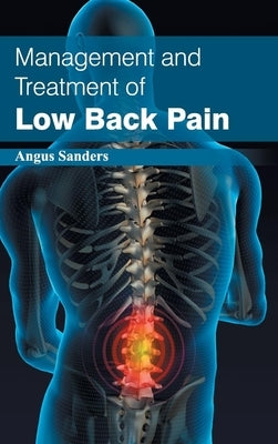 Management and Treatment of Low Back Pain by Sanders, Angus