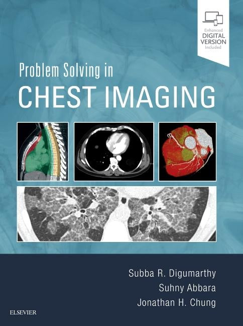 Problem Solving in Chest Imaging by Digumarthy, Subba R.