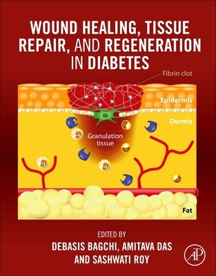 Wound Healing, Tissue Repair, and Regeneration in Diabetes by Bagchi, Debasis