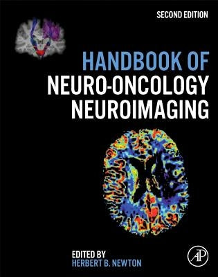 Handbook of Neuro-Oncology Neuroimaging by Newton, Herbert B.
