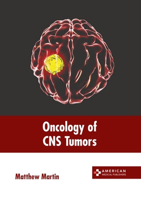 Oncology of CNS Tumors by Martin, Matthew