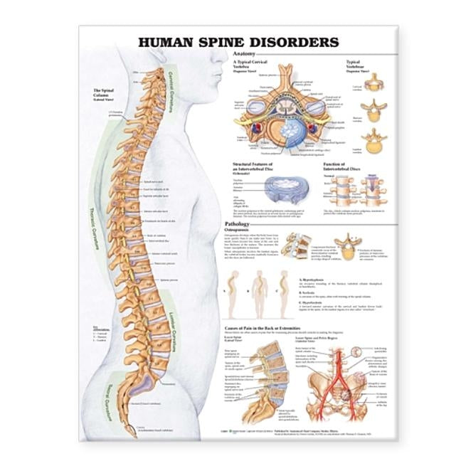 Human Spine Disorders Anatomical Chart by Anatomical Chart Company