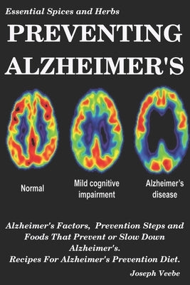 Preventing Alzheimer's: Alzheimer's Factors, Prevention Steps and Foods That Prevent or Slow Alzheimer's, Recipes for Alzheimer's Prevention D by Veebe, Joseph