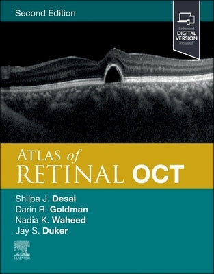 Atlas of Retinal Oct: Optical Coherence Tomography by Duker, Jay S.