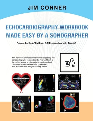 Echocardiography Workbook: Echocardiography Made Easy By A Sonographer by Conner, Jim