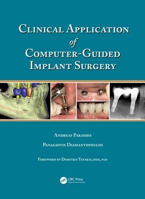Clinical Application of Computer-Guided Implant Surgery by Parashis, Andreas