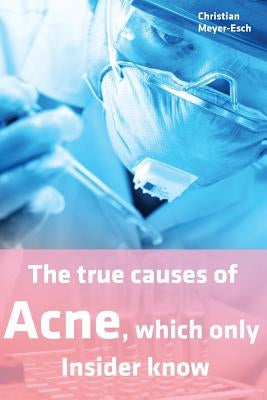 The true causes of Acne, which only Insider know by Meyer-Esch, Christian