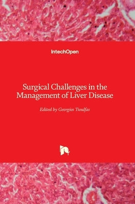 Surgical Challenges in the Management of Liver Disease by Tsoulfas, Georgios