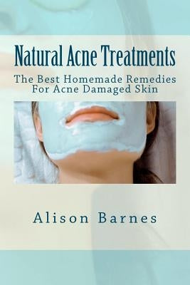 Natural Acne Treatments: The Best Homemade Remedies For Acne Damaged Skin by Barnes, Alison