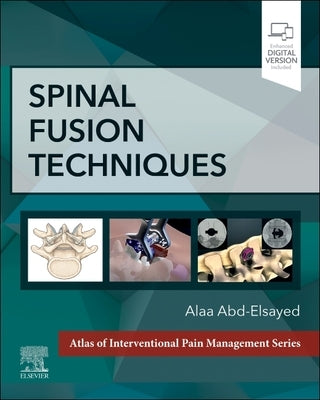 Spinal Fusion Techniques by Abd-Elsayed, Alaa