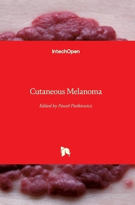 Cutaneous Melanoma by Pietkiewicz, Pawel