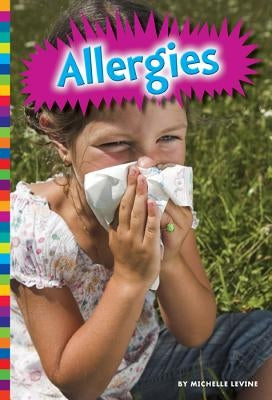 Allergies by Levine, Michelle