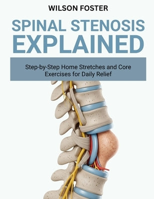 Spinal Stenosis Explained: Symptoms, Movement Tips, and Comfort Plans for Better Walking and Sleep by Foster, Wilson