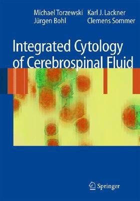 Integrated Cytology of Cerebrospinal Fluid by Torzewski, Michael