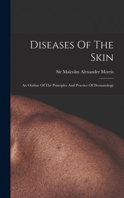 Diseases Of The Skin: An Outline Of The Principles And Practice Of Dermatology by Sir Malcolm Alexander Morris