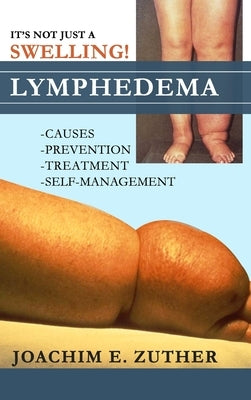 It's Not Just a Swelling! Lymphedema: Causes, Prevention, Treatment, Self-Management by Zuther, Joachim