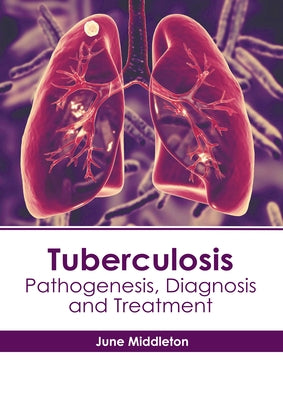 Tuberculosis: Pathogenesis, Diagnosis and Treatment by Middleton, June