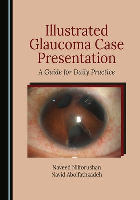 Illustrated Glaucoma Case Presentation: A Guide for Daily Practice by Nilforushan, Naveed