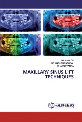Maxillary Sinus Lift Techniques by Gill, Harvinder