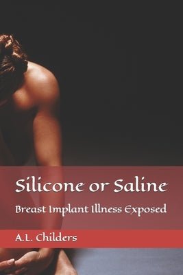 Silicone or Saline: Breast Implant Illness Exposed by Childers, A. L.