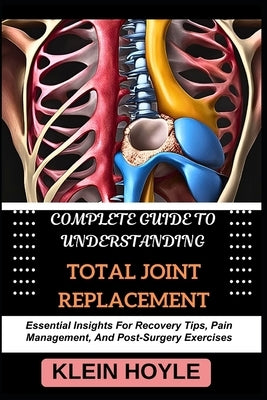 Complete Guide to Understanding Total Joint Replacement: Essential Insights For Recovery Tips, Pain Management, And Post-Surgery Exercises by Hoyle, Klein